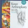 Master Techniques in Orthopaedic Surgery Knee Arthroplasty 3rd Edition