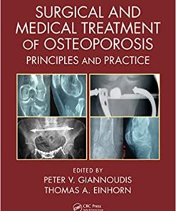 Surgical and Medical Treatment of Osteoporosis Principles and Practice