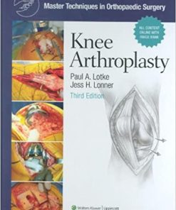 Master Techniques in Orthopaedic Surgery Knee Arthroplasty 3rd Edition