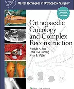 Master Techniques in Orthopaedic Surgery Orthopaedic Oncology and Complex Reconstruction