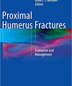 Proximal Humerus Fractures Evaluation and Management