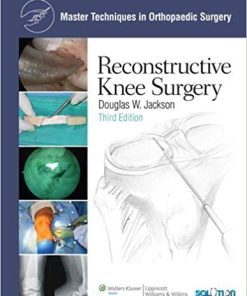 Master Techniques in Orthopaedic Surgery Reconstructive Knee Surgery 3rd Edition
