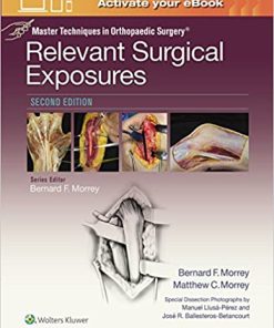 Master Techniques in Orthopaedic Surgery Relevant Surgical Exposures 2nd Edition