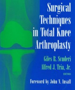 Surgical Techniques in Total Knee Arthroplasty