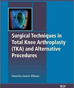 Surgical Techniques in Total Knee Arthroplasty and Alternative Procedures