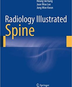 Radiology Illustrated Spine