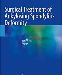 Surgical Treatment of Ankylosing Spondylitis Deformity