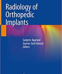 Radiology of Orthopedic Implants