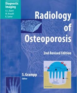Radiology of Osteoporosis 2nd Edition