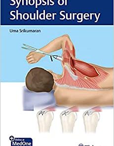 Synopsis of Shoulder Surgery