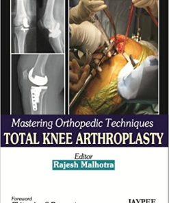 Mastering Orthopedic Techniques Total Knee Arthroplasty