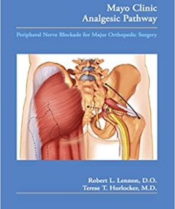 Mayo Clinic Analgesic Pathway Peripheral Nerve Blockade for Major Orthopedic Surgery