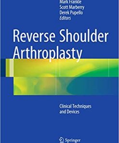 Reverse Shoulder Arthroplasty Biomechanics Clinical Techniques and Current Technologies
