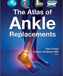 The Atlas of Ankle Replacements