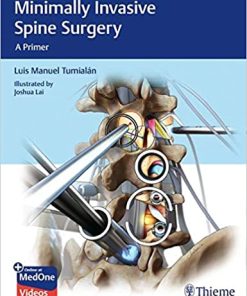 Minimally Invasive Spine Surgery A Primer