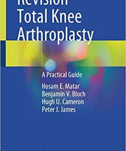 Revision Total Knee Arthroplasty A Practical Guide