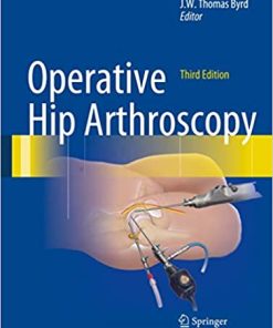 Operative Hip Arthroscopy 3rd Edition