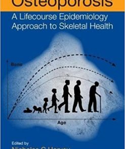 Osteoporosis A Lifecourse Epidemiology Approach to Skeletal Health