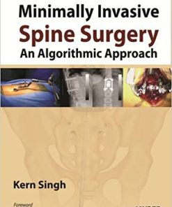 Minimally Invasive Spine Surgery An Algorithmic Approach