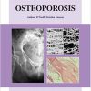 Osteoporosis An Atlas Of Investigation And Diagnosis