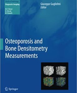 Osteoporosis and Bone Densitometry Measurements