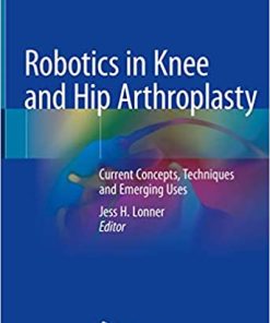 Robotics in Knee and Hip Arthroplasty Current Concepts Techniques and Emerging Uses