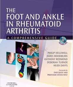 The Foot and Ankle in Rheumatoid Arthritis A Comprehensive Guide