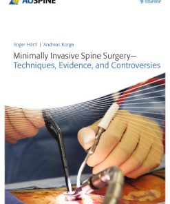 Minimally Invasive Spine Surgery Techniques Evidence and Controversies