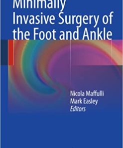 Minimally Invasive Surgery of the Foot and Ankle