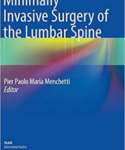 Minimally Invasive Surgery of the Lumbar Spine