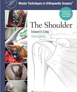 The Master Techniques in Orthopaedic Surgery Shoulder 3rd Edition