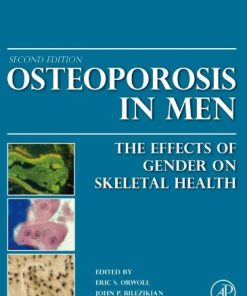 Osteoporosis in Men The Effects of Gender on Skeletal Health 2nd Edition