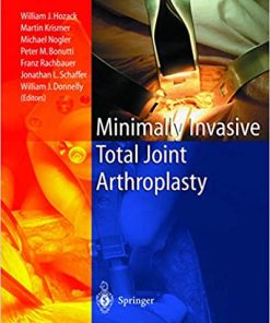 Minimally Invasive Total Joint Arthroplasty