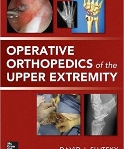 Operative Orthopedics of the Upper Extremity