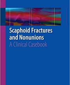 Scaphoid Fractures and Nonunions A Clinical Casebook