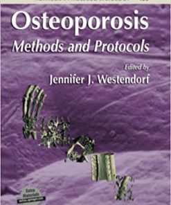 Osteoporosis Methods and Protocols