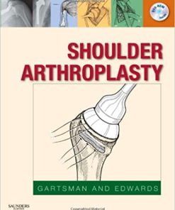 Shoulder Arthroplasty