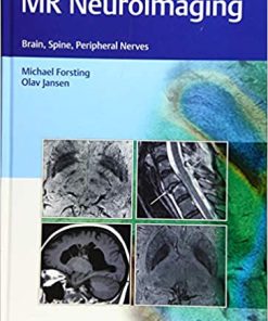 MR Neuroimaging Brain Spine Peripheral Nerves