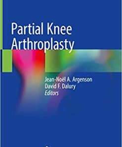 Partial Knee Arthroplasty