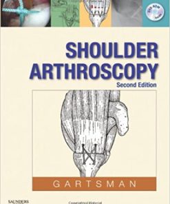 Shoulder Arthroscopy 2nd Edition