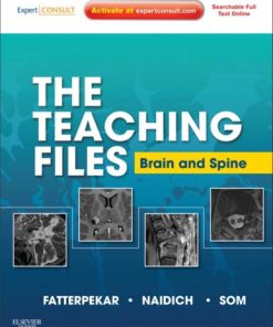 The Teaching Files Brain and Spine Imaging