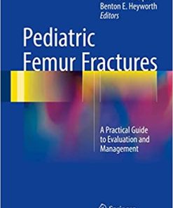 Pediatric Femur Fractures A Practical Guide to Evaluation and Management