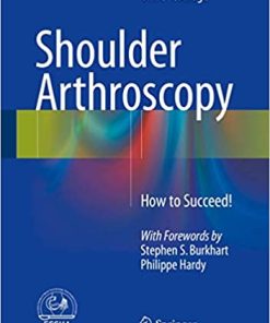 Shoulder Arthroscopy How to Succeed