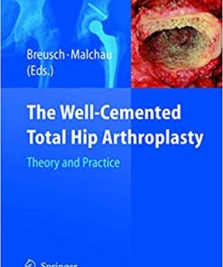 The Well Cemented Total Hip Arthroplasty Theory and Practice