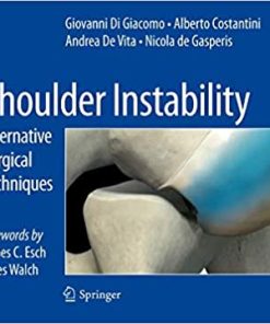 Shoulder Instability Alternative Surgical Techniques