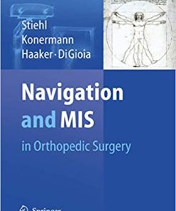 Navigation and MIS in Orthopedic Surgery