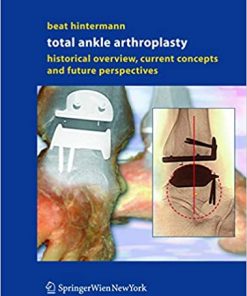 Total Ankle Arthroplasty Historical Overview Current Concepts and Future Perspectives