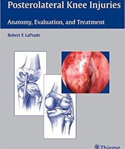 Posterolateral Knee Injuries Anatomy Evaluation and Treatment