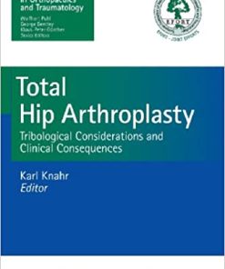 Total Hip Arthroplasty Tribological Considerations and Clinical Consequences