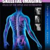 Skeletal Imaging Atlas of the Spine and Extremities 2nd Edition